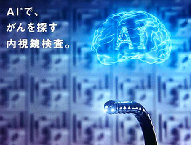 内視鏡画像診断支援システム